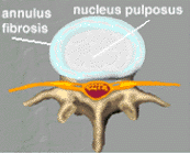 disco costituito da nucleo polposo e anulus fibroso